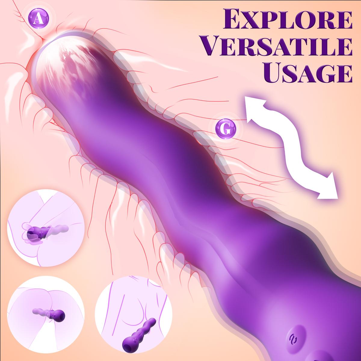 Multi-contact placement graphic for Vanimira and Novisera